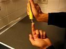 Splitter im Finger entfernen - mit Klebstoff