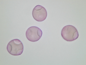 Einzelheiten beim Elektronenmikroskop (Biologie, Zellen, Mikroskop)