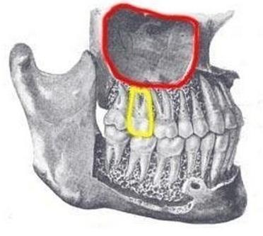 Bild 1 - (Gesundheit, Schmerzen, Zähne)