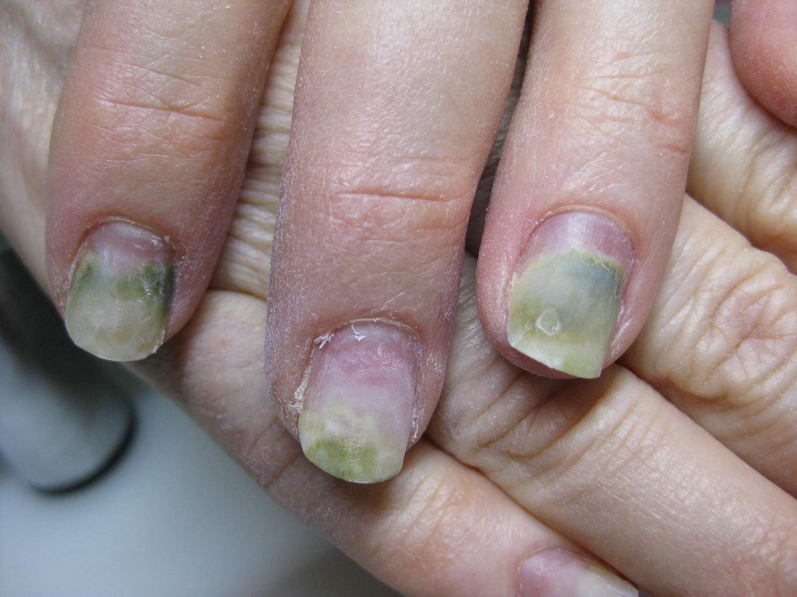 Ab wann darf ich in das Nagelstudio? (Alter, Nägel) Ab wann darf ich in das Nagelstudio? (Alter, Nägel)