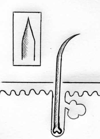 wachsen die nasenhaare dann dicker und