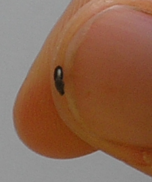 Was sind das für Dinger? Im Stuhl gefunden (Medizin, Arzt, Eier)