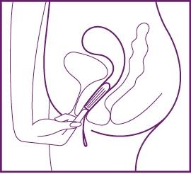 tampon tut weh