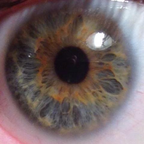 Mein Auge - (Augen, Augenfarbe, heterochromie)