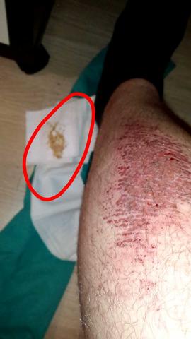 - (Medizin, Arzt, Fußball)