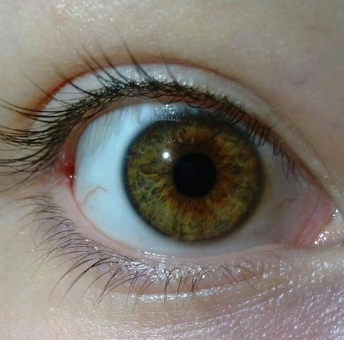 So sieht mein Auge aus. Vorher war es ganz Braun. - (Augen, Pubertät, Gesicht)