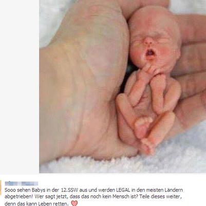 Wie Funktioniert Abtreibung Ab Wann Erlaubt Kinder Schwangerschaft Schwanger Wie Funktioniert Abtreibung Ab Wann Erlaubt Kinder Schwangerschaft Schwanger