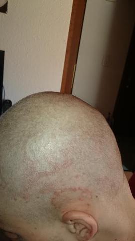 8.April 2015 - (Haare, Hautpflege, Kopfhaut)