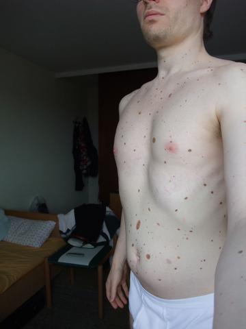 Was Passiert Bei Einem Hautscreening Gesundheit Arzt Ausziehen Was Passiert Bei Einem Hautscreening Gesundheit Arzt Ausziehen