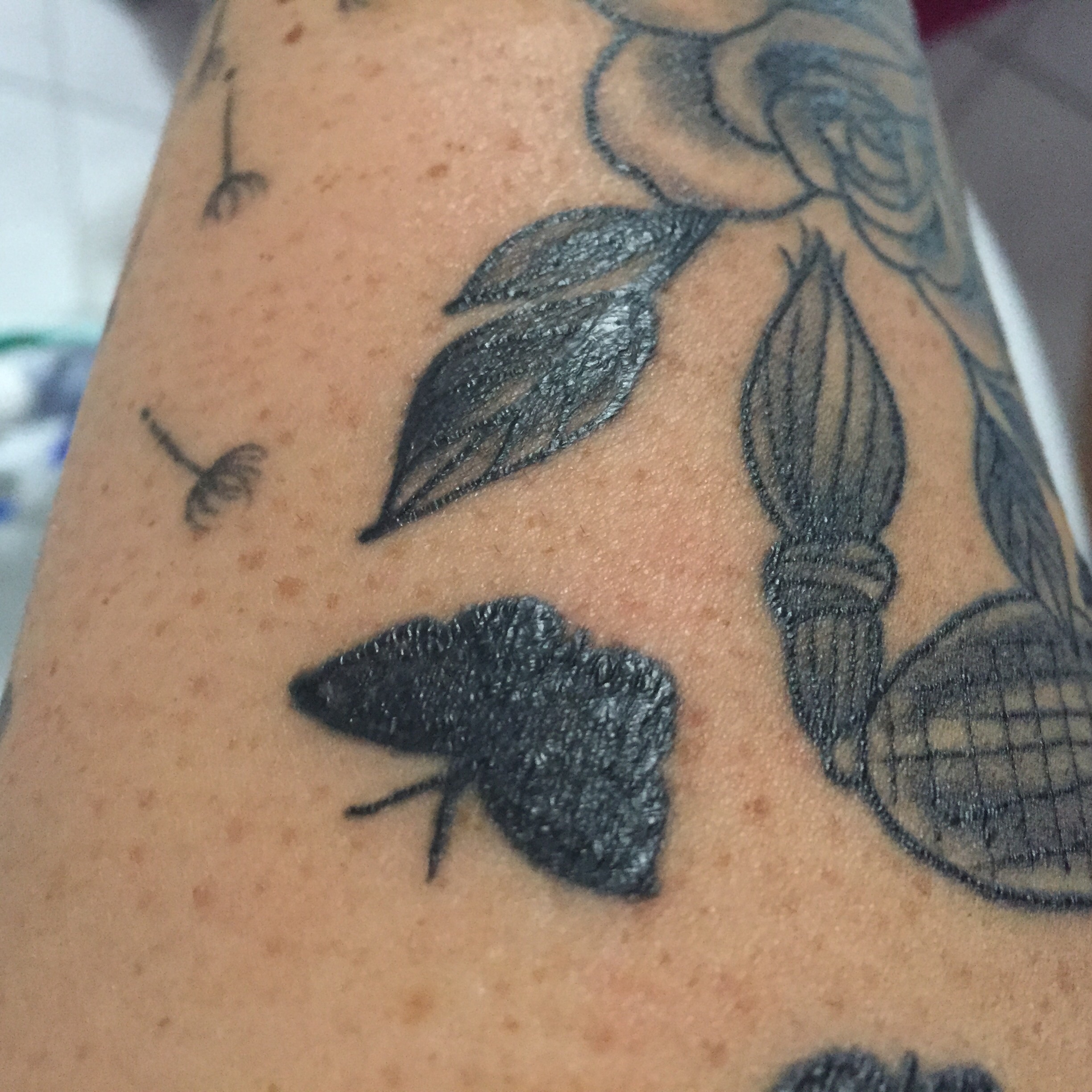 Mein zwei Wochen altes Tattoo hat so komische schwarze stellen! Sieht