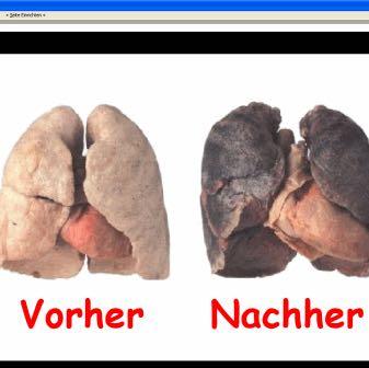Ob Rauchen aufgegeben hat es wird die Tachykardie gehen