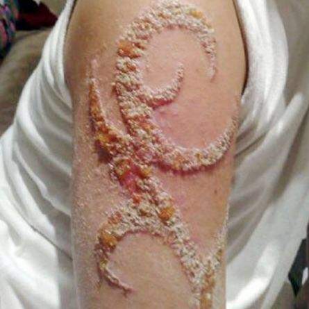 Henna Tattoo erst Braun (hell) dann schwarz ist das natürlich oder ...