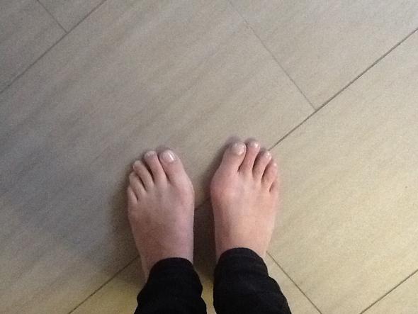- (Orthopäde, Hallux Valgus, fusschirurgie)