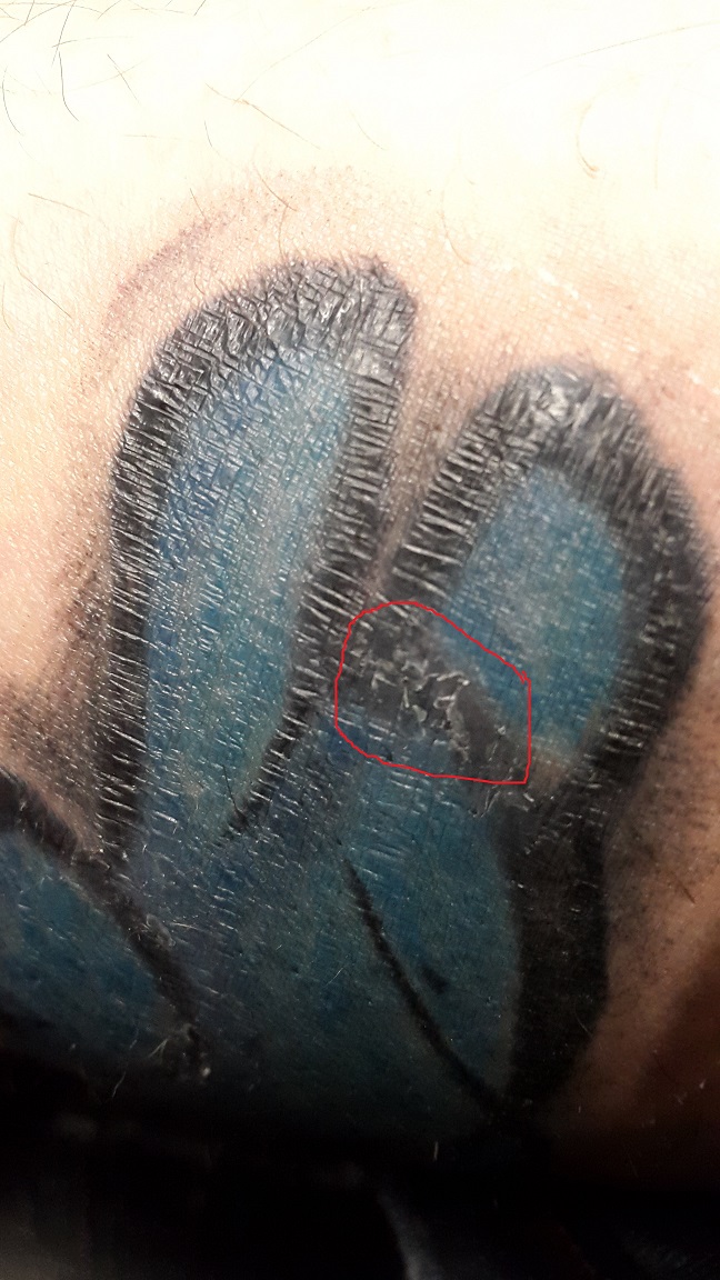 Tattoo Heilungsprozess ist das normal? (Pflege, Heilung, Wundheilung)