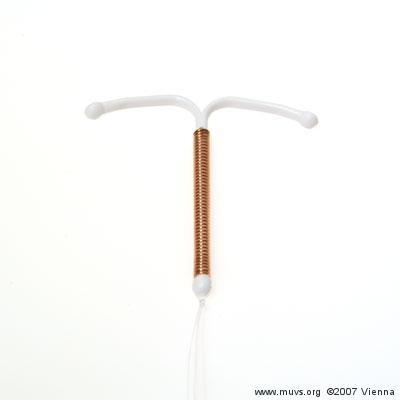 Hat jemand Erfahrungen mit der Kupferspirale? (Verhütung ...