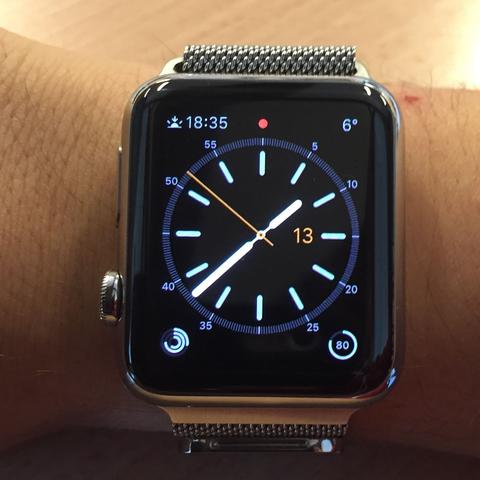 Meine Apple Watch  - (Technologie, Apple Watch, watch)