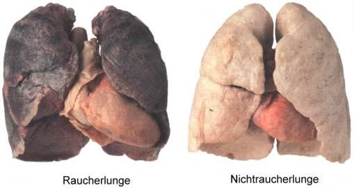 Die Schadstoffe und der Rauch an sich zerstören die Alveolen in der Lunge - (Jungs, Rauchen, gruppenzwang)