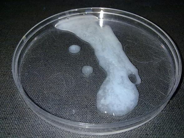 Sperma (nein ist kein Bild von mir) Internet lässt grüßen :) - (Penis, Sperma)