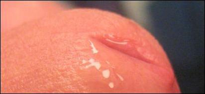 Lusttropfen (nein ist kein Bild von mir) Internet lässt grüßen :) - (Penis, Sperma)
