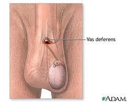 Medizinische Frage Bezugl Des Hoden Medizin Sack Medizinische Frage Bezugl Des Hoden Medizin Sack
