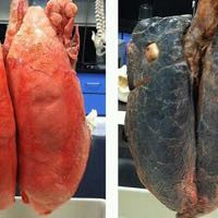 Raucher gegen gesunde Lunge - (E-Shisha, Mindestalter, wo wann)