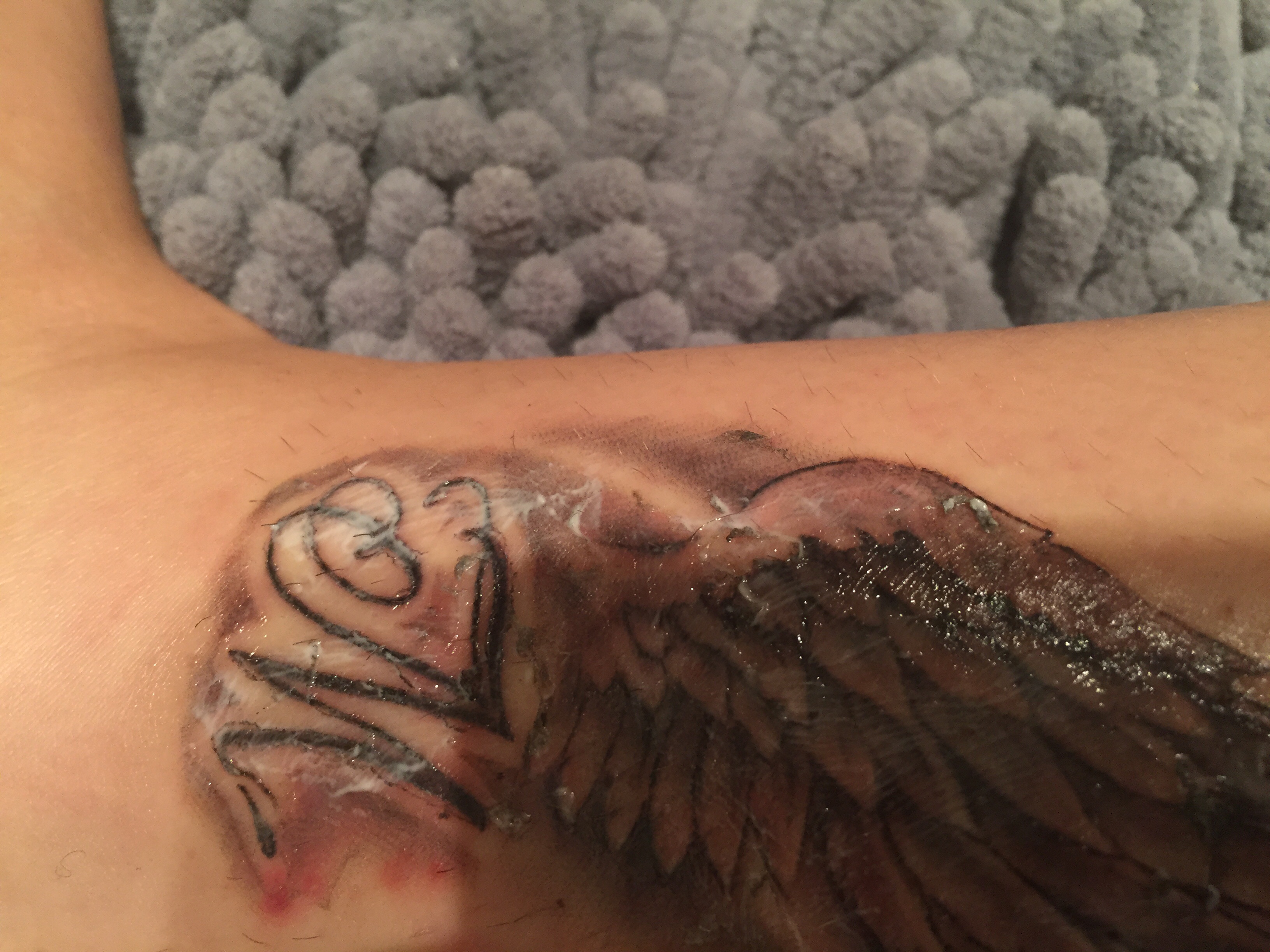 Entzündetes tattoo? (Pickel, Entzündung, Heilung)