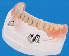  - (Zahnarzt, Zahnmedizin, Zahnersatz)