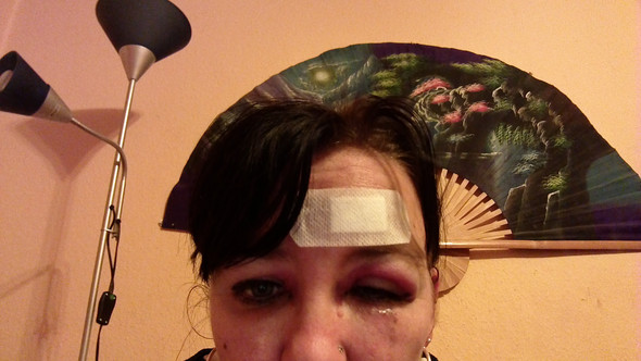Was ist das? - (Gesundheit, Operation, ambulante OP)