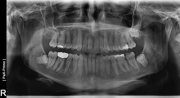 Hagen dating Hagen dating