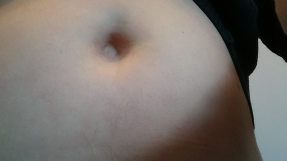 Bauchnabelbruch operieren lassen für einen normalen Bauchnabel Bauchnabelbruch operieren lassen für einen normalen Bauchnabel