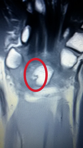 Bin verzweifelt Bin verzweifelt