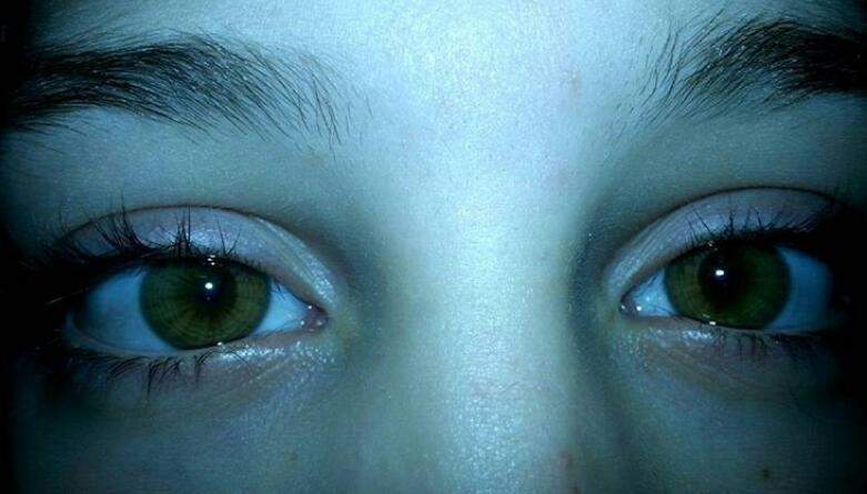 Warum gibt es grüne Augen? (grün, Augenfarbe)