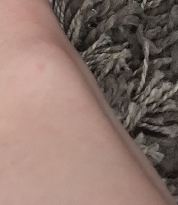 Knochen - (Hand, Knochen)