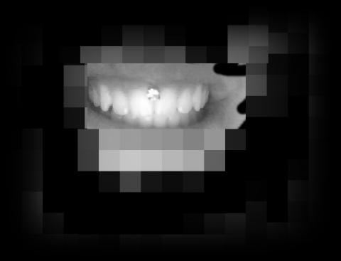- (Zähne, Piercing)