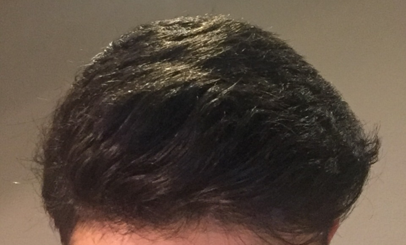 - (Haarpflege, Kraftvolleres Haar)