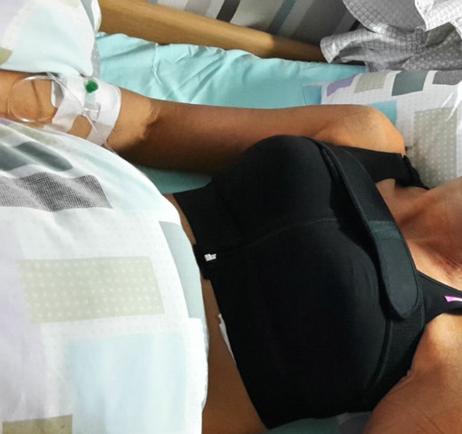 Nach Brustvergrosserung Spitze Und Seitliche Bruste Brustvergrosserung Seitlich