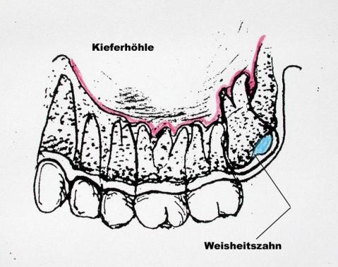 - (Gesundheit, Medizin, Arzt)
