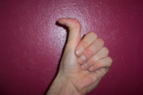 Hypermobilität - (Wachstum, Finger, Gelenke)
