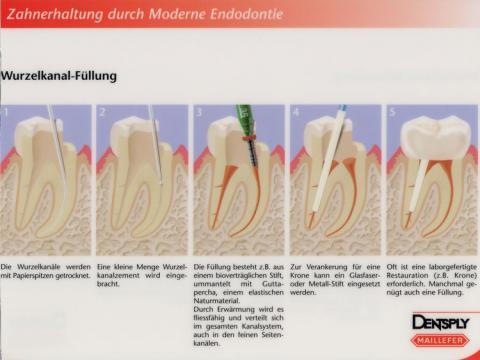 Man Kann Einen Zahn Auch Offen Lassen Medizin Zahne Medikamente Man Kann Einen Zahn Auch Offen Lassen Medizin Zahne Medikamente