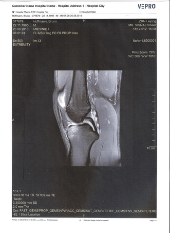 - (Gesundheit, Knie)