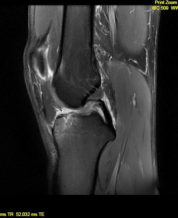 - (Gesundheit, Knie)