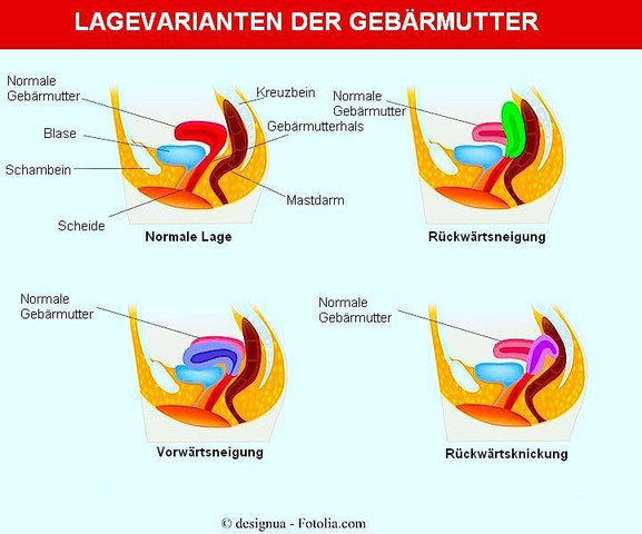 Kann Mir Bitte Jemand Mit Dem Divacup Helfen Frauen Periode Menstruation Kann Mir Bitte Jemand Mit Dem Divacup Helfen Frauen Periode Menstruation
