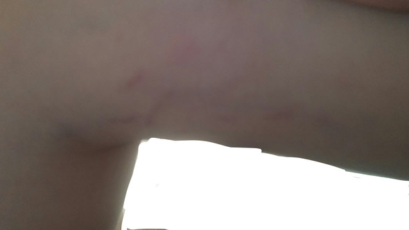 bild 3 - (Arzt, Haut, Beine)