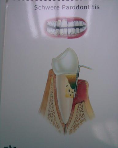  - (Zähne, Zahnarzt, Zahnmedizin)