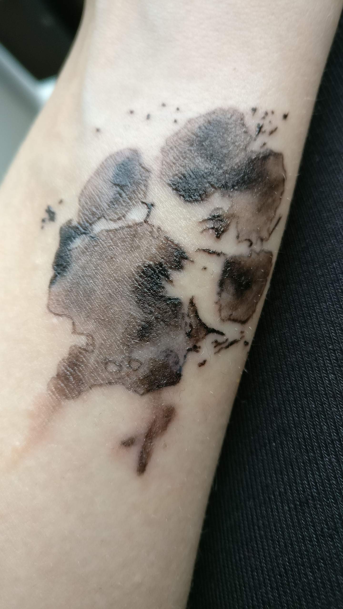 Neues Tattoo juckt, pellt sich und es bilden sich Pickel? (Creme, jucken)