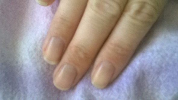 hoffe man sieht es trotz des Nagellacks - (Gesundheit, Alkohol, Drogen)