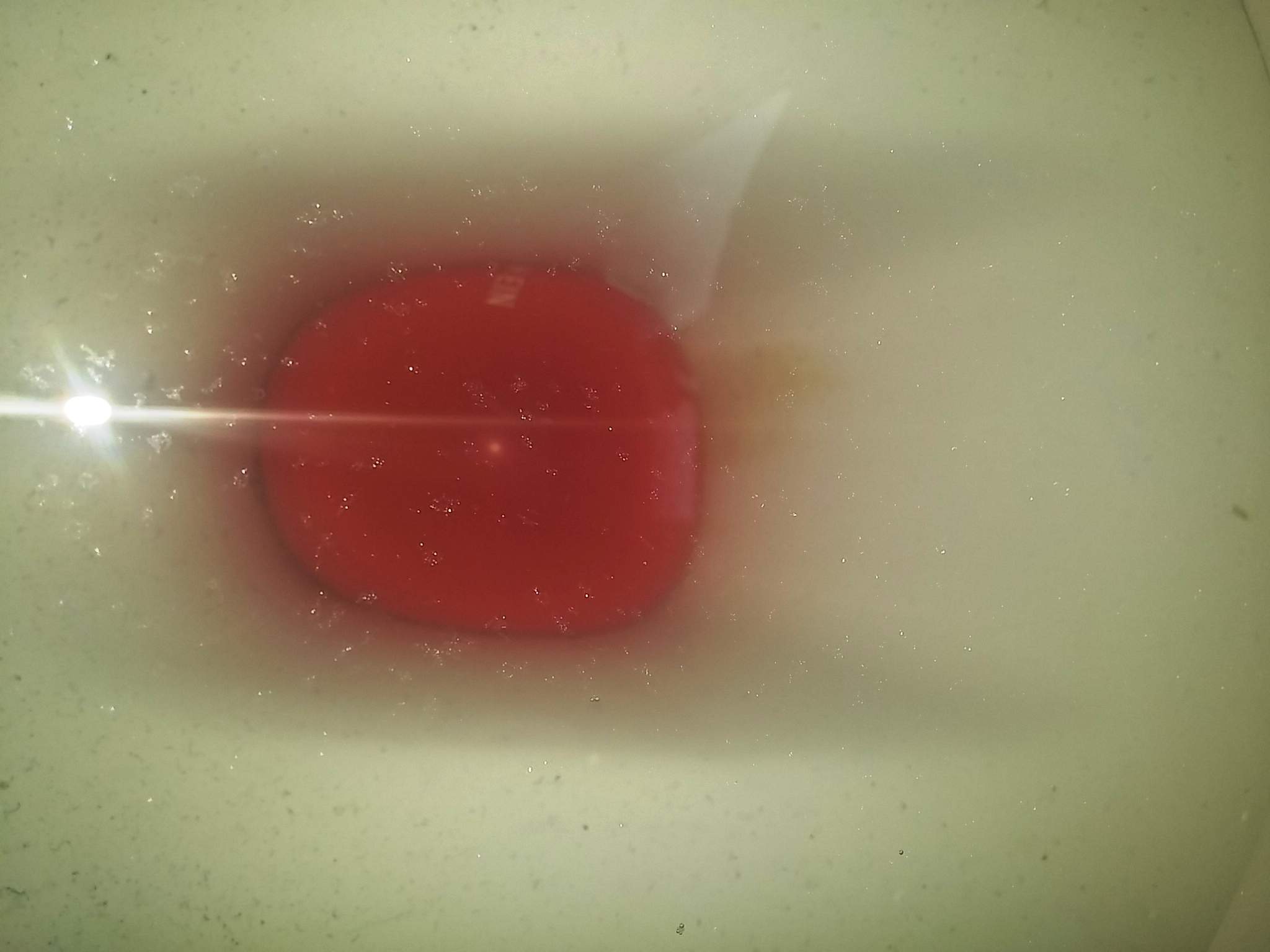 Braune Kalkspur im WC wie entfernen? (Toilette, Kalk, salzsaeure)