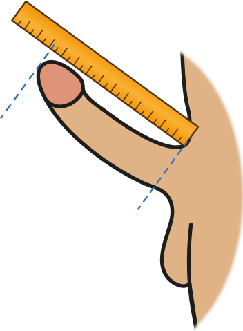 Wie wird ein penis gemessen