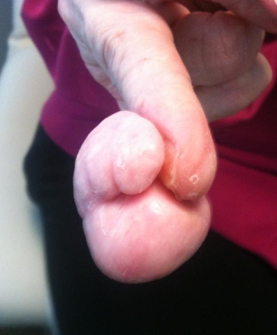 - (Medizin, Finger)