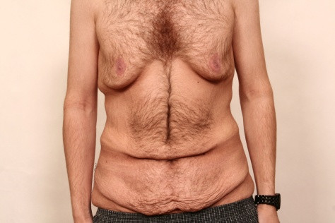30 kg abnehmen in 6 monaten